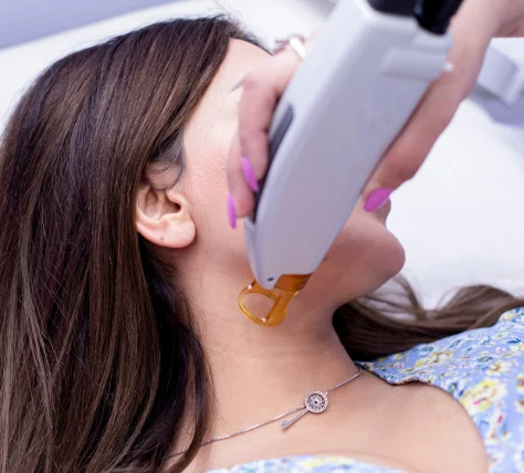 neck laser hair removal