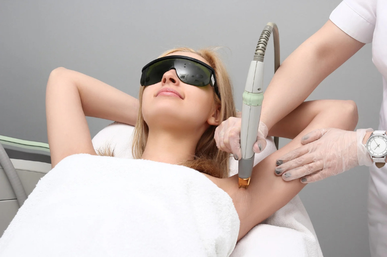 arms laser hair removal